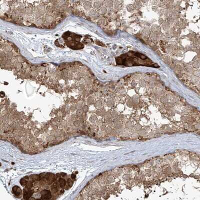 Immunohistochemistry-Paraffin: PLEKHM3 Antibody [NBP1-94090]