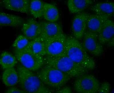Immunocytochemistry/ Immunofluorescence: PLGF Antibody (JA63-15) [NBP2-67067]