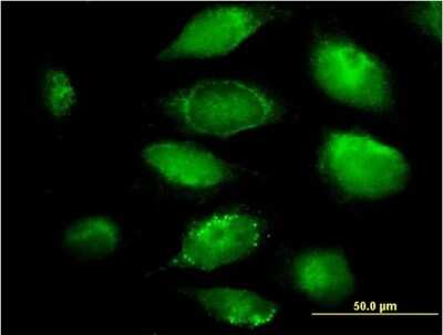 Immunocytochemistry/ Immunofluorescence: PLGLB2 Antibody (3E6) [H00005342-M04]