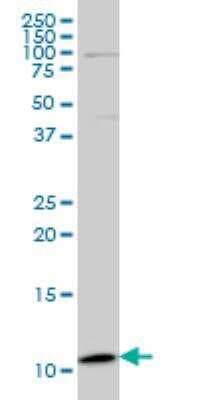 Western Blot: PLGLB2 Antibody (3E6) [H00005342-M04]