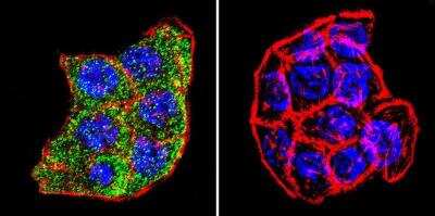 Immunocytochemistry/ Immunofluorescence: PLK1 Antibody (13E8) [NB100-74502]