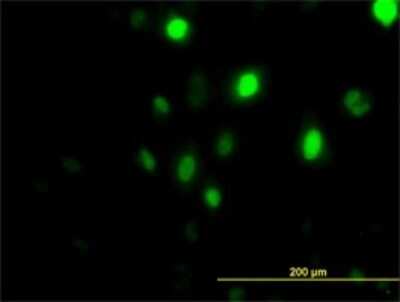 Immunocytochemistry/ Immunofluorescence: PLK1 Antibody (2G12) [H00005347-M01]