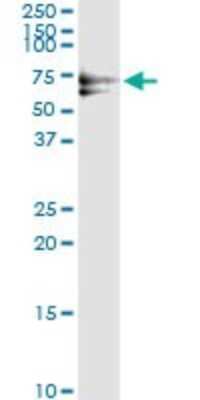 Immunoprecipitation: PLK1 Antibody (2G12) [H00005347-M01]