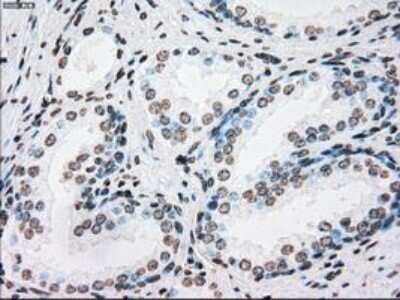 Immunohistochemistry: PLK1 Antibody (OTI1D4) - Azide and BSA Free [NBP2-73472]