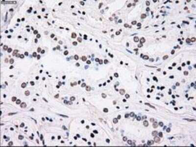 Immunohistochemistry: PLK1 Antibody (OTI1D4) - Azide and BSA Free [NBP2-73472]