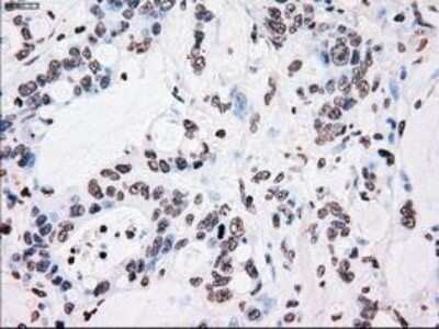 Immunohistochemistry-Paraffin: PLK1 Antibody (OTI1D4) [NBP1-48291]