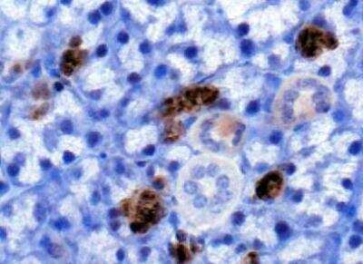 Immunohistochemistry: PLK5 Antibody [NBP1-97306]