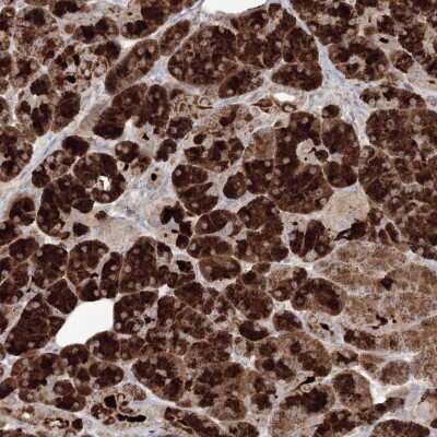 Immunohistochemistry: PLK5 Antibody [NBP2-48630]