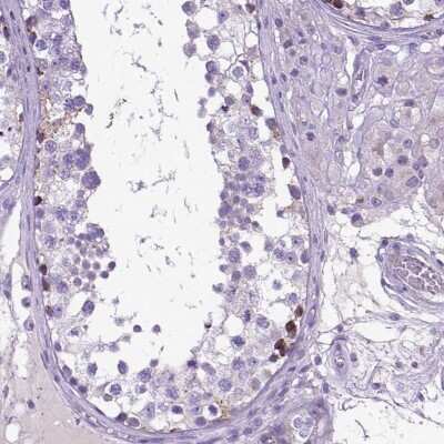 Immunohistochemistry-Paraffin: PLK5 Antibody [NBP2-48630]
