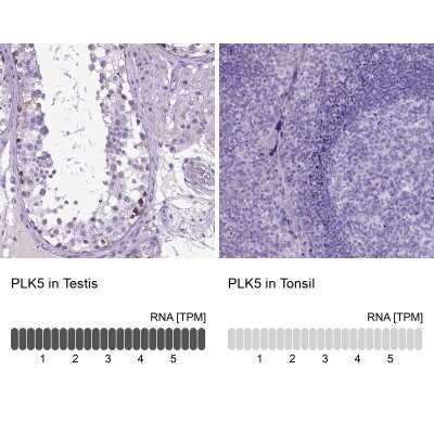 Immunohistochemistry-Paraffin: PLK5 Antibody [NBP2-48630]