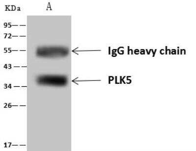 Immunoprecipitation: PLK5 Antibody [NBP3-12602]