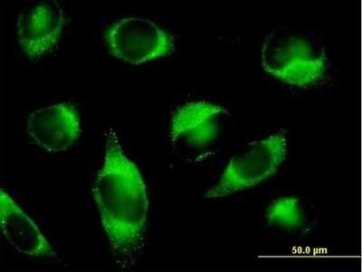 Immunocytochemistry/ Immunofluorescence: PLOD3 Antibody [H00008985-B01P]