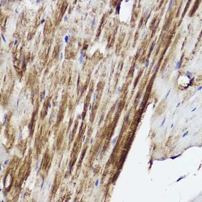 Immunohistochemistry-Paraffin: PLOD3 Antibody - BSA Free [NBP2-94177]