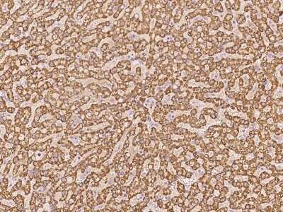 Immunohistochemistry-Paraffin: PLP2 Antibody [NBP3-06290]