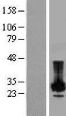 Western Blot: PLP2 Overexpression Lysate [NBP2-08081]