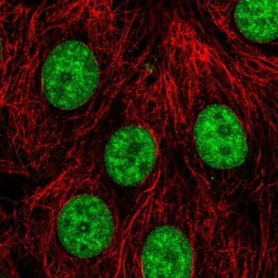 Immunocytochemistry/ Immunofluorescence: PLRG1 Antibody [NBP2-56917]