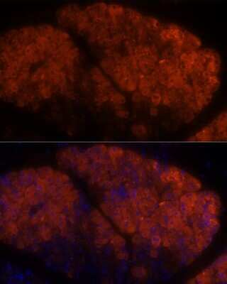 Immunohistochemistry: PLRP1 Antibody - Azide and BSA Free [NBP2-94066]