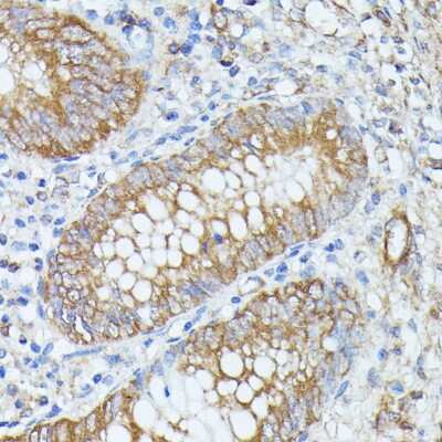 Immunohistochemistry-Paraffin: PLRP1 Antibody - Azide and BSA Free [NBP2-94066]