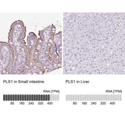 Immunohistochemistry-Paraffin: PLS1 Antibody [NBP2-30592]