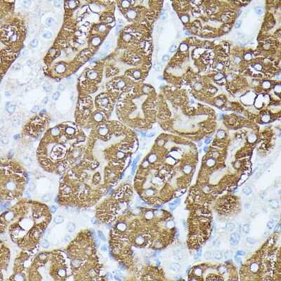 Immunohistochemistry-Paraffin: PLS1 Antibody - Azide and BSA Free [NBP2-94642]
