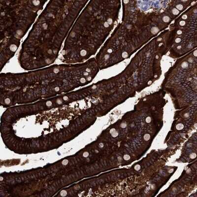 Immunohistochemistry-Paraffin: PLS1 Antibody [NBP3-17087]