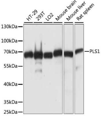 Western Blot: PLS1 AntibodyAzide and BSA Free [NBP2-94642]
