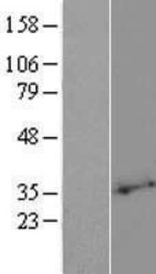 Western Blot: PLSCR2 Overexpression Lysate [NBP2-06661]