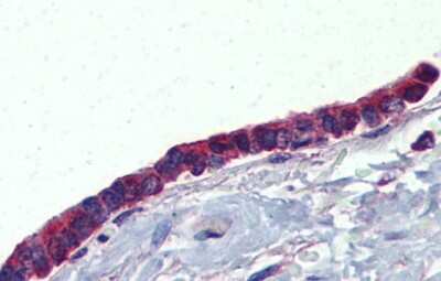 Immunohistochemistry: PLUNC Antibody [NBP1-58979]