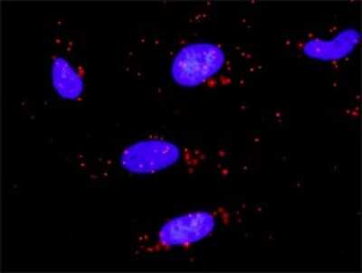 Proximity Ligation Assay: PLZF Antibody (3A7) [H00007704-M01]