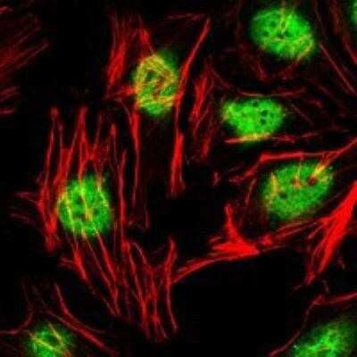 Immunocytochemistry/ Immunofluorescence: PLZF Antibody (5B3) - BSA Free [NBP1-51632]