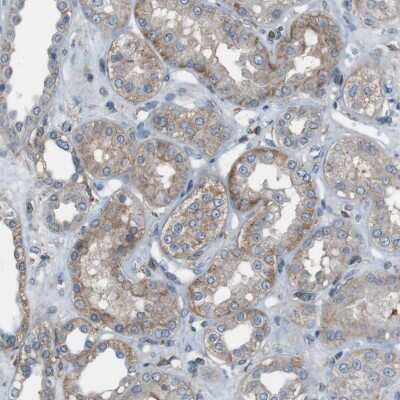 Immunohistochemistry-Paraffin: PMCA1 Antibody [NBP1-87260]