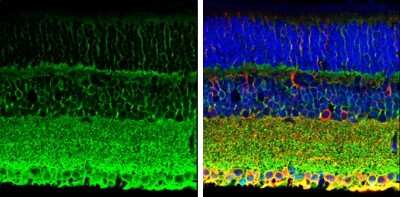 Immunohistochemistry-Paraffin: PMCA1 Antibody [NBP3-12964]