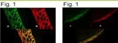 Immunocytochemistry/ Immunofluorescence: PMCA4 Antibody (JA9) [NB300-569]