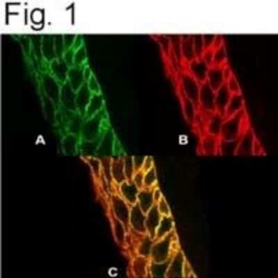 Immunocytochemistry/ Immunofluorescence: PMCA4 Antibody (JA9) [NB300-569]