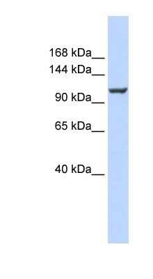 Western Blot: PMCA4 Antibody [NBP1-59481]