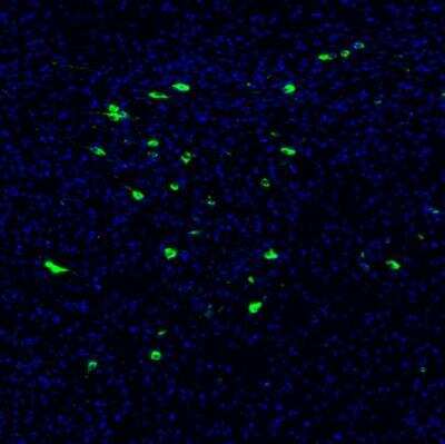 Immunohistochemistry: PMCH Antibody [NBP2-13780]