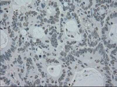 Immunohistochemistry-Paraffin: PMEL17/SILV Antibody (OTI10E5) [NBP1-47974]