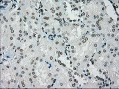 Immunohistochemistry-Paraffin: PMEL17/SILV Antibody (OTI10E5) [NBP1-47974]