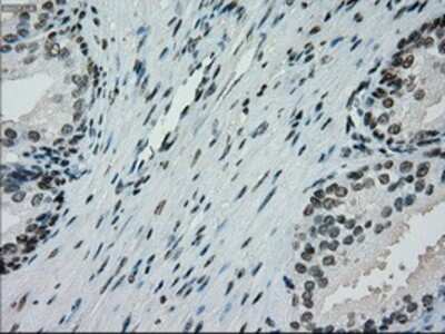 Immunohistochemistry-Paraffin: PMEL17/SILV Antibody (OTI10E5) [NBP1-47974]