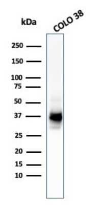 Western Blot: PMEL17/SILV Antibody (HMB45 + PMEL/783)Azide and BSA Free [NBP2-47780]