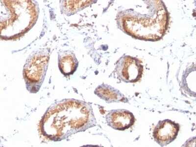 Immunohistochemistry-Paraffin: PMEL17/SILV Antibody (HMB45 + PMEL/783) [NBP2-44523]