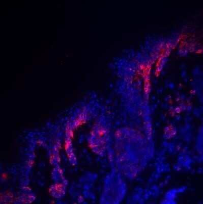 Immunohistochemistry: PMEL17/SILV Antibody (HMB45) - Azide and BSA Free [NBP2-34638]