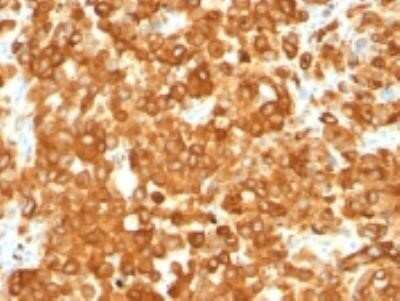 Immunohistochemistry-Paraffin: PMEL17/SILV Antibody (HMB45) - Azide and BSA Free [NBP2-34638]