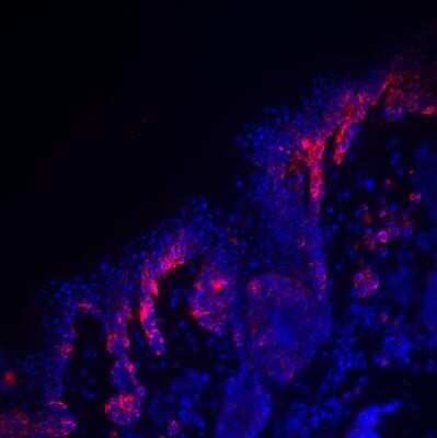 Immunohistochemistry: PMEL17/SILV Antibody (HMB45) [NBP2-44520]