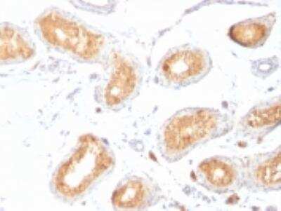 Immunohistochemistry-Paraffin: PMEL17/SILV Antibody (HMB45) [NBP2-44520]