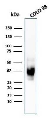 Western Blot: PMEL17/SILV Antibody (HMB45) [NBP2-44520]
