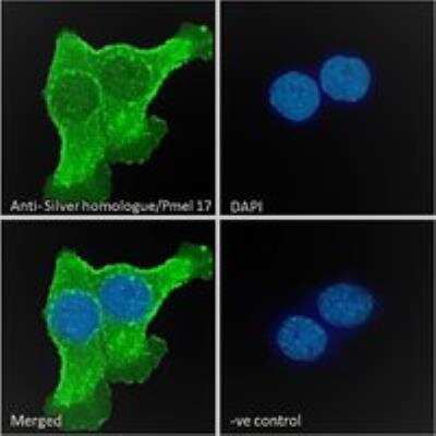 Immunocytochemistry/ Immunofluorescence: PMEL17/SILV Antibody [NB100-41098]