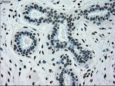 Immunohistochemistry: PMEL17/SILV Antibody (OTI10E5) - Azide and BSA Free [NBP2-73479]