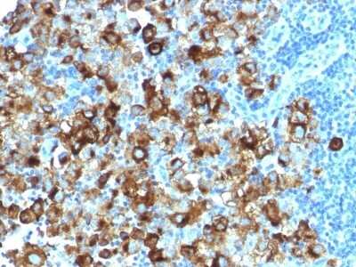 Immunohistochemistry-Paraffin: PMEL17/SILV Antibody (PMEL/1825R) - Azide and BSA Free [NBP2-54454]