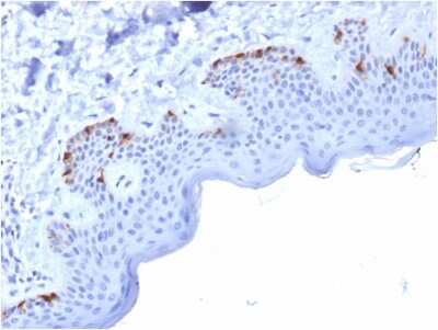Immunohistochemistry-Paraffin: PMEL17/SILV Antibody (PMEL/2037) [NBP3-07782]